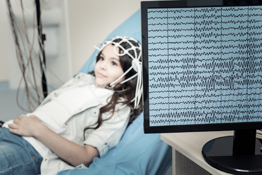Electroencephalogram (EEG)